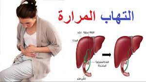 ألم المرارة.. كيفية التمييز بينه وبين آلام المعدة الأخرى||||||||||ألم المرارة.. كيفية التمييز بينه وبين آلام المعدة الأخرى||ألم المرارة.. كيفية التمييز بينه وبين آلام المعدة الأخرى||ألم المرارة.. كيفية التمييز بينه وبين آلام المعدة الأخرى