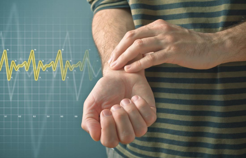 متلازمة النبض 